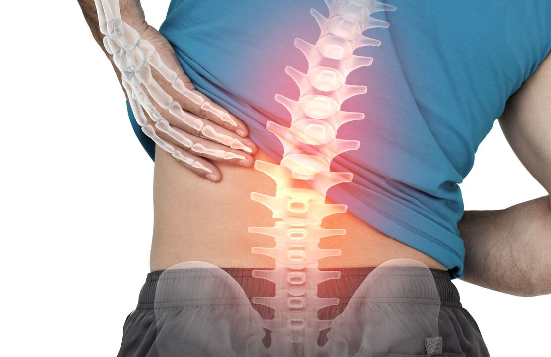 Niebezpieczeństwo ostechondrozy lędźwiowej