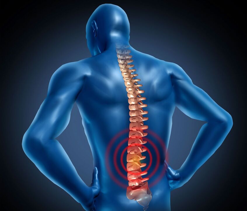 Osteochondroza lędźwiowa