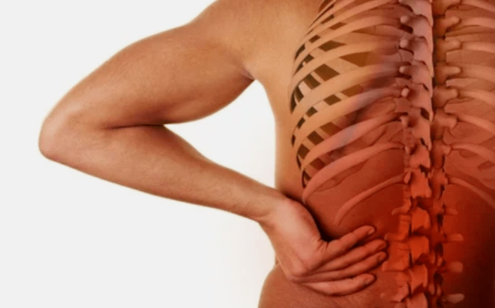 Przyczyny osteochondrozy lędźwiowej