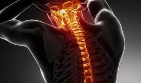 Osteochondroza całego kręgosłupa