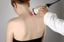 Leczenie osteochondrozy szyjnej za pomocą laseroterapii